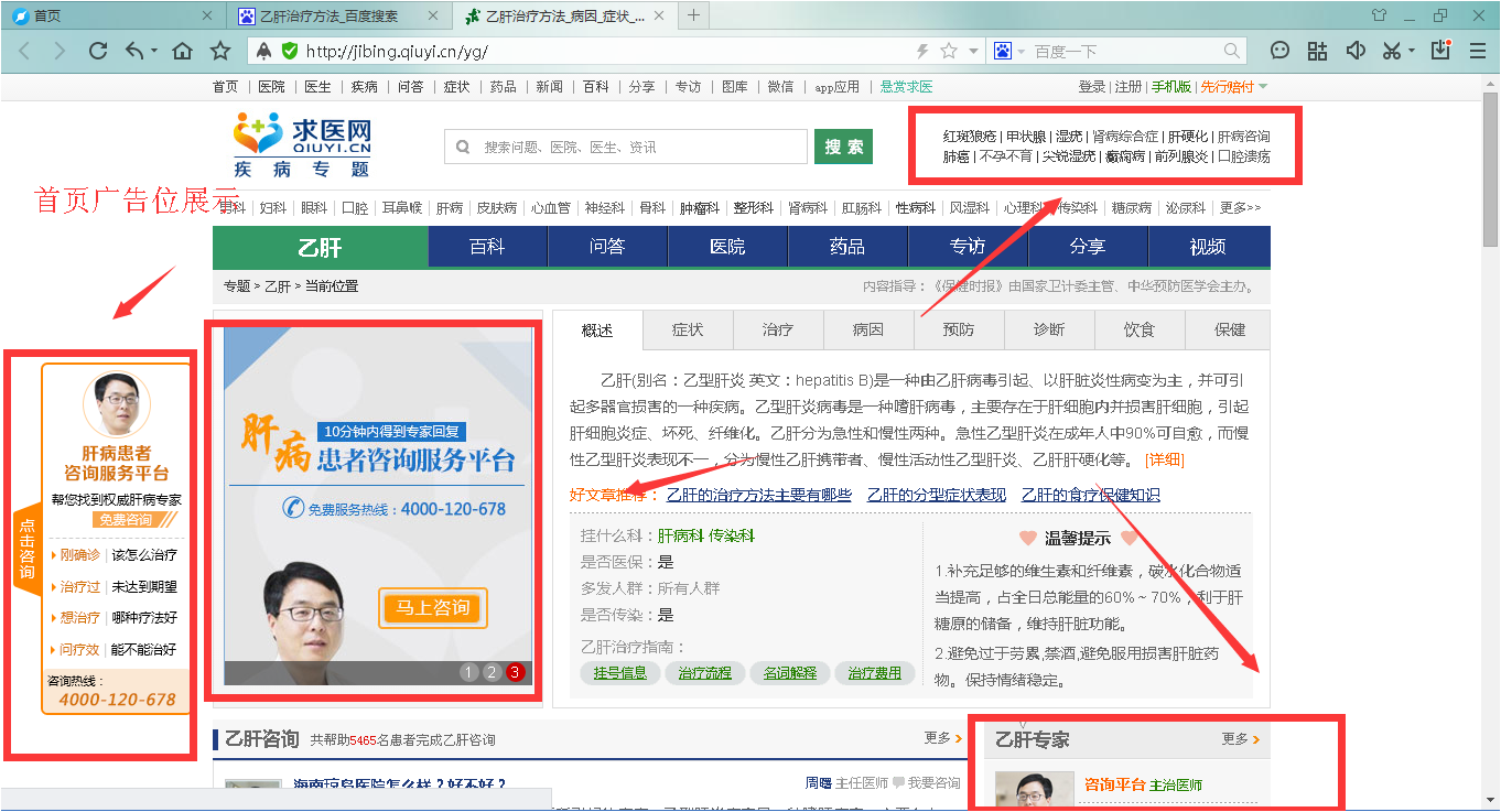 求医网广告